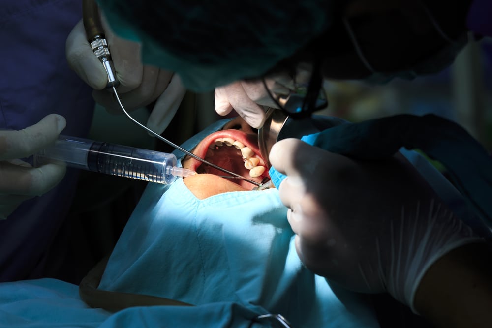 Oral Surgery Near Me: Expert Care Close to Home in Rockingham